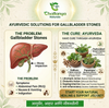 Gasostone Tablet+ Disostone Tablet ( Combo Pack)